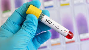 EUA APROVAM PRIMEIRA VACINA PREVENTIVA CONTRA O VIH/SIDA